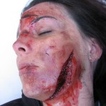 face lacerations 1